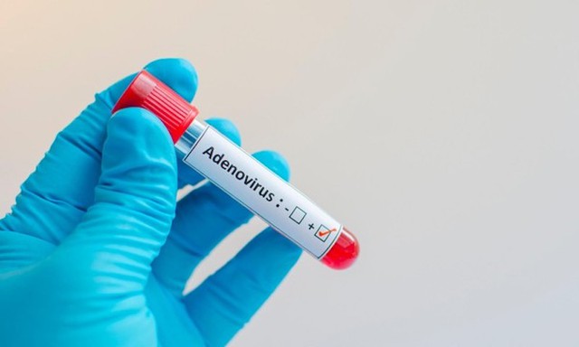 Adenovirus tiếp tục điểm hơn 1.400 ca, 7 trẻ tử vong: Cha mẹ cần phân biệt rõ với bệnh hô hấp thường - Ảnh 2.